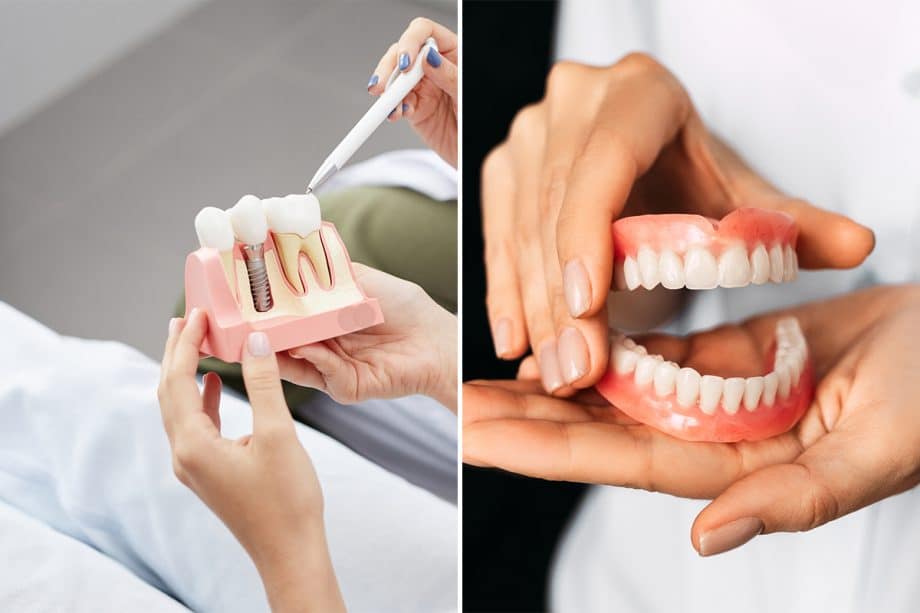 Dental Implants vs Dentures Which Is Right for You