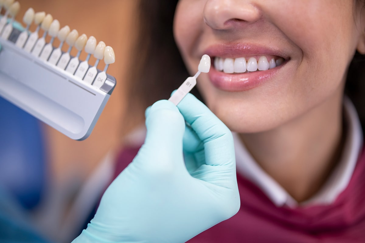 How long dental crowns typically last with proper care blog