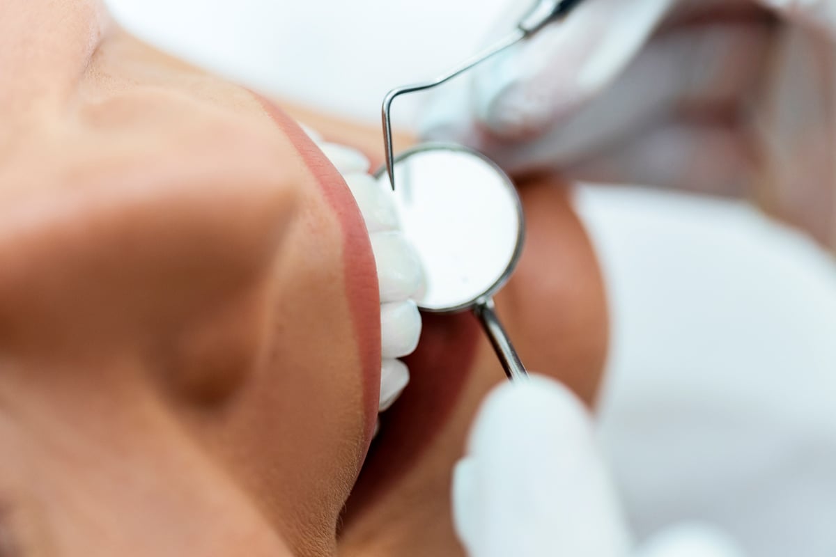 How much do porcelain veneers cost blog.jpg