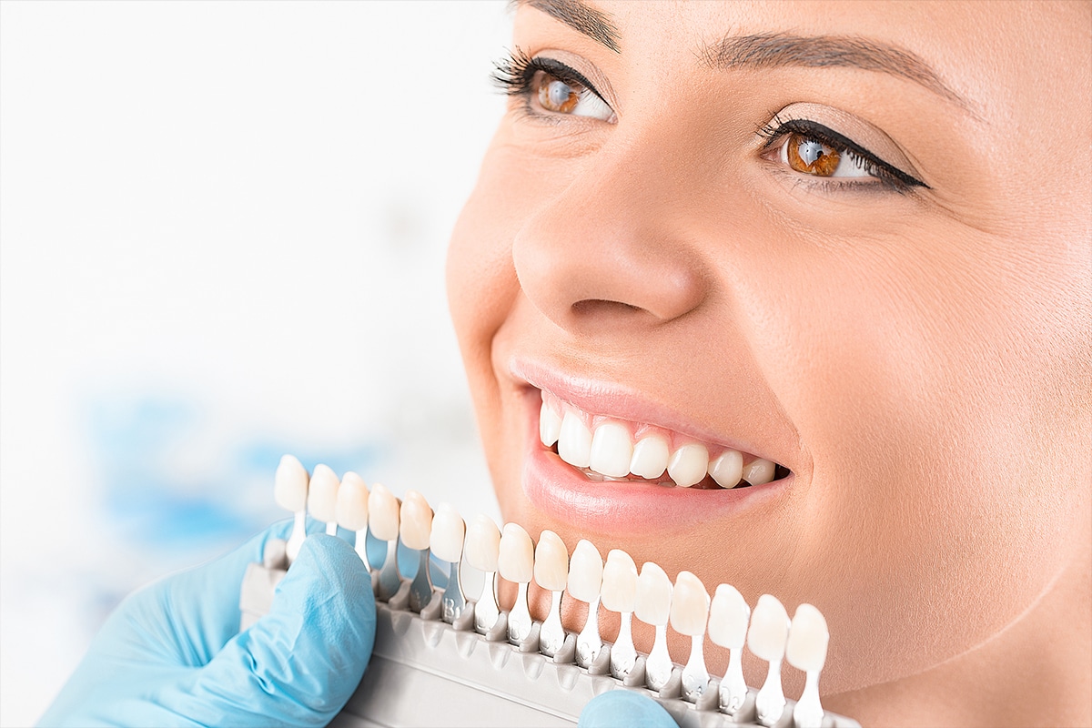 How much does teeth whitening cost in stuart fl.jpg